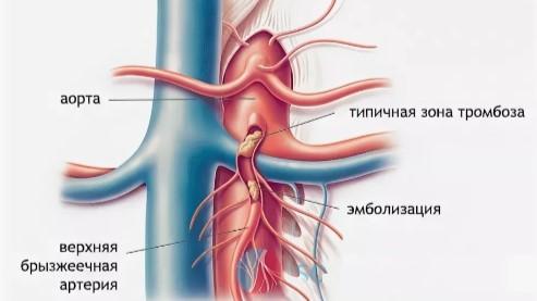 иллюстрация ООКБ